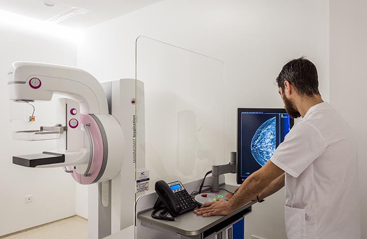 HC Marbella incorpora la tomosíntesis para detectar mejor el cáncer de mama