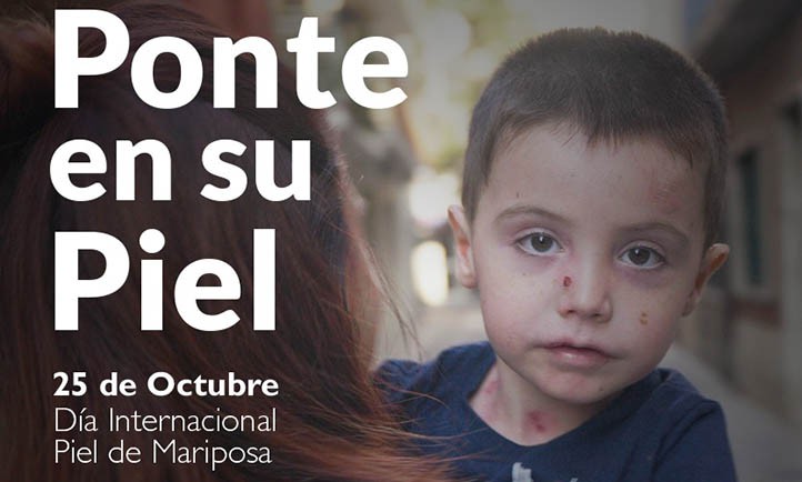 DEBRA lanza una campaña para generar empatía con la piel de mariposa