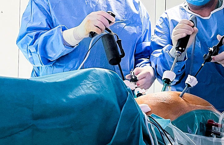 Cirugía robotizada laparoscópica con visión 3D en el hospital HC Marbella