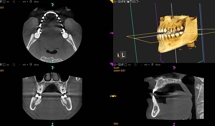 Quirónsalud Marbella incorpora la radiografía panorámica dental de alta resolución