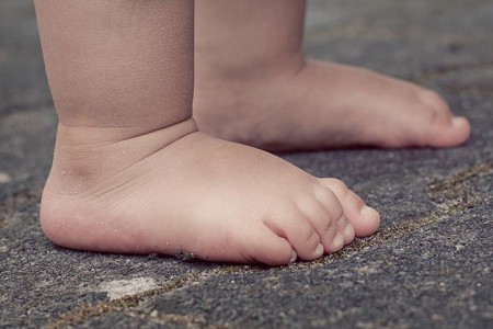 La observación de los padres es clave para detectar alteraciones ortopédicas