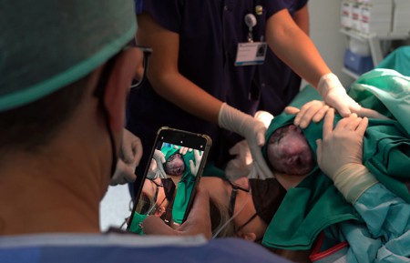 Quirónsalud Marbella implanta la cesárea humanizada con participación activa de la madre